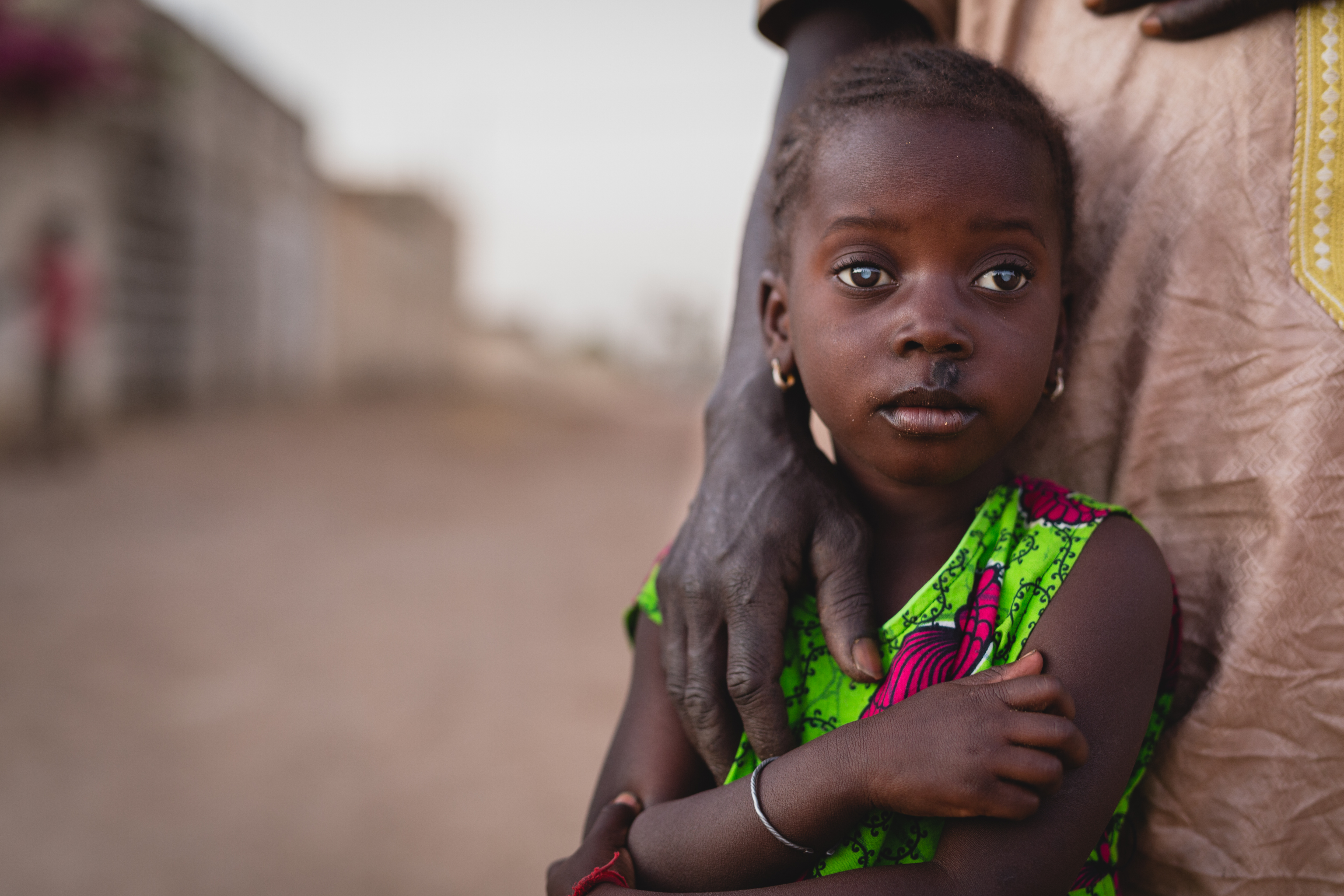 Mossane cataracts patient, at home before surgery with father.